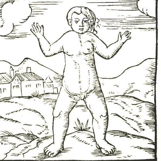 Hermafrodita, tomado del libro "Monstruos y prodigios" de Ambroise Paré