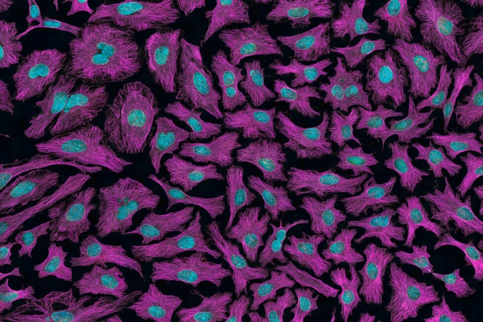 Fotografía del National Cancer Institute a través de Unsplash